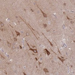 Invitrogen SPHKAP Polyclonal Antibody 100 &mu;L; Unconjugated:Antibodies,