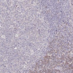 Invitrogen SPHKAP Polyclonal Antibody 100 &mu;L; Unconjugated:Antibodies,