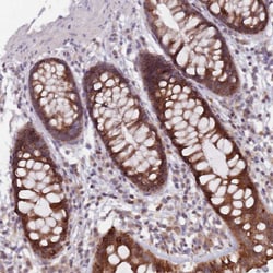 Invitrogen ADAL Polyclonal Antibody 100 &mu;L; Unconjugated:Antibodies,