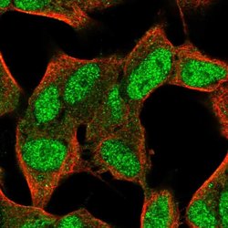 Invitrogen FAM124A Polyclonal Antibody 100 &mu;L | Buy Online | Invitrogen&trade; | Fisher Scientific