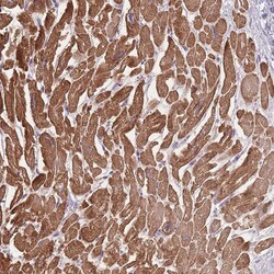 Invitrogen FAM124A Polyclonal Antibody 100 &mu;L | Buy Online | Invitrogen&trade; | Fisher Scientific