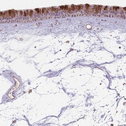 Invitrogen CCDC168 Polyclonal Antibody 100 &mu;L; Unconjugated:Antibodies,