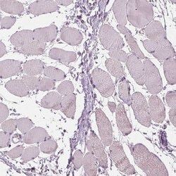 Invitrogen DAK Polyclonal Antibody 100 &mu;L; Unconjugated:Antibodies,