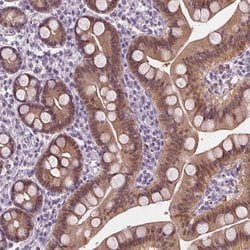 Invitrogen DAK Polyclonal Antibody 100 &mu;L; Unconjugated:Antibodies,