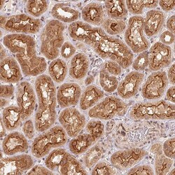 Invitrogen C18orf14 Polyclonal Antibody 100 &mu;L | Buy Online | Invitrogen&trade; | Fisher Scientific