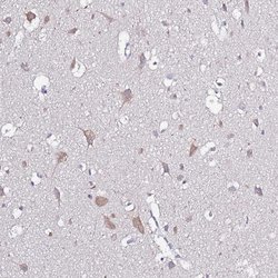Invitrogen GLCE Polyclonal Antibody 100 &mu;L; Unconjugated:Antibodies,