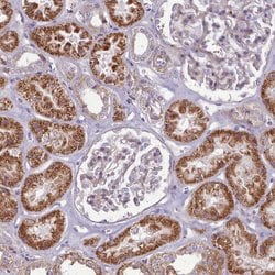 Invitrogen PAPD5 Polyclonal Antibody 100 &mu;L; Unconjugated:Antibodies,