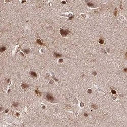 Invitrogen GLYR1 Polyclonal Antibody 100 &mu;L; Unconjugated:Antibodies,