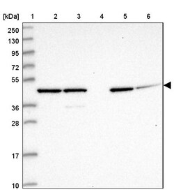 Invitrogen GAS8 Polyclonal Antibody 100 &mu;L | Buy Online | Invitrogen&trade; | Fisher Scientific
