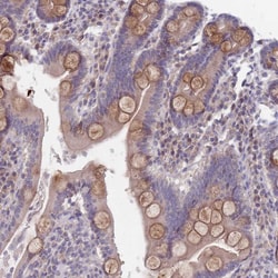 Invitrogen FTSJD1 Polyclonal Antibody 100 &mu;L; Unconjugated:Antibodies,