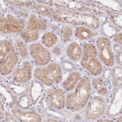 Invitrogen FTSJD1 Polyclonal Antibody 100 &mu;L; Unconjugated:Antibodies,