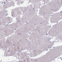 Invitrogen FTSJD1 Polyclonal Antibody 100 &mu;L; Unconjugated:Antibodies,