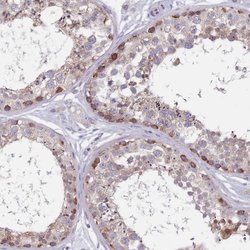 Invitrogen FTSJD1 Polyclonal Antibody 100 &mu;L; Unconjugated:Antibodies,