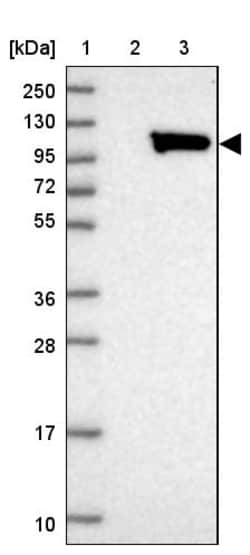 Invitrogen ALS2CL Polyclonal Antibody 100 &mu;L | Buy Online | Invitrogen&trade; | Fisher Scientific