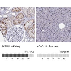 Invitrogen ACAD11 Polyclonal Antibody 100 &mu;L; Unconjugated:Antibodies,