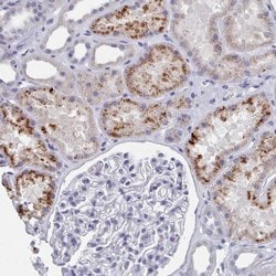 Invitrogen ACAD11 Polyclonal Antibody 100 &mu;L; Unconjugated:Antibodies,