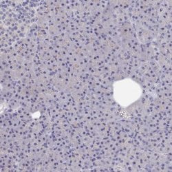 Invitrogen ACAD11 Polyclonal Antibody 100 &mu;L; Unconjugated:Antibodies,
