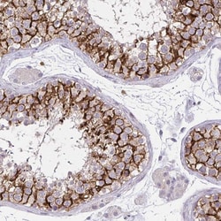 KIAA1210 Polyclonal Antibody:Antibodies, Polyclonal