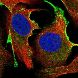 Invitrogen CTDSPL Polyclonal Antibody 100 &mu;L; Unconjugated:Antibodies,