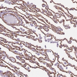 Invitrogen CTDSPL Polyclonal Antibody 100 &mu;L; Unconjugated:Antibodies,