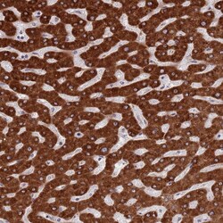 Invitrogen ZNF140 Polyclonal Antibody 100 &mu;L; Unconjugated:Antibodies,