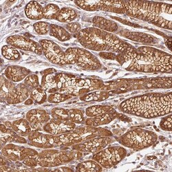 Invitrogen Adenylate Cyclase 4 Polyclonal Antibody 100 &mu;L; Unconjugated:Antibodies,