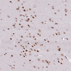 Invitrogen SELH Polyclonal Antibody 100 &mu;L; Unconjugated:Antibodies,