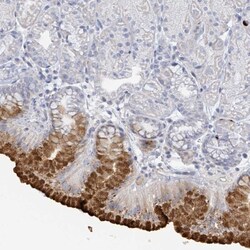 Invitrogen RAB33B Polyclonal Antibody 100 &mu;L; Unconjugated:Antibodies,