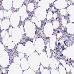 Invitrogen IBTK Polyclonal Antibody 100 &mu;L; Unconjugated:Antibodies,