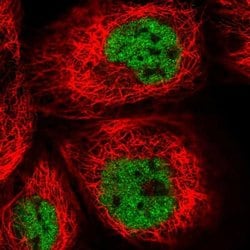 Invitrogen UBXN7 Polyclonal Antibody 100 &mu;L; Unconjugated:Antibodies,