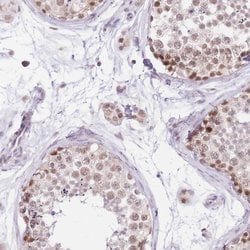 Invitrogen UBXN7 Polyclonal Antibody 100 &mu;L; Unconjugated:Antibodies,