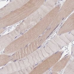 Invitrogen UBXN7 Polyclonal Antibody 100 &mu;L; Unconjugated:Antibodies,