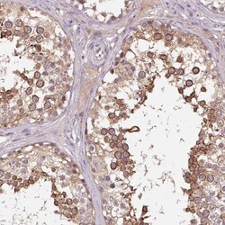 Invitrogen KIAA1257 Polyclonal Antibody 100 &mu;L; Unconjugated:Antibodies,