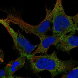 Invitrogen KIAA1257 Polyclonal Antibody 100 &mu;L; Unconjugated:Antibodies,
