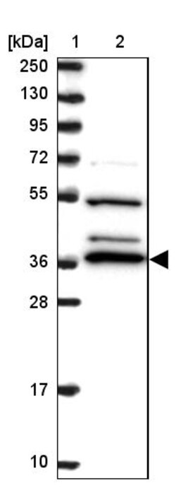 Invitrogen BPNT1 Polyclonal Antibody 100 &mu;L | Buy Online | Invitrogen&trade; | Fisher Scientific