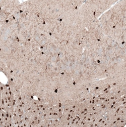 Invitrogen TMEM255A Polyclonal Antibody 100 &mu;L; Unconjugated:Antibodies,