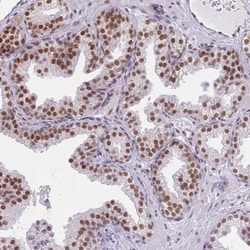 Invitrogen ZBED5 Polyclonal Antibody 100 &mu;L; Unconjugated:Antibodies,