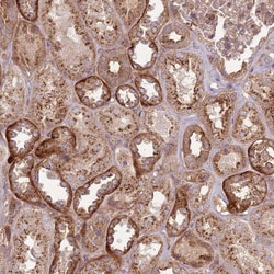Invitrogen ANKRD24 Polyclonal Antibody 100 &mu;L; Unconjugated:Antibodies,