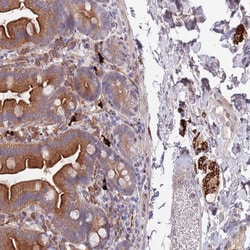 Invitrogen NLRP6 Polyclonal Antibody 100 &mu;L; Unconjugated:Antibodies,