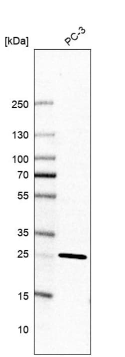 Invitrogen TMEM55B Polyclonal Antibody 100 &mu;L; Unconjugated:Antibodies,