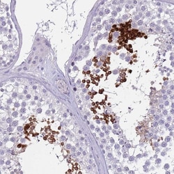 Invitrogen SPAG4L Polyclonal Antibody 100 &mu;L; Unconjugated:Antibodies,
