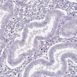 Invitrogen SPAG4L Polyclonal Antibody 100 &mu;L; Unconjugated:Antibodies,