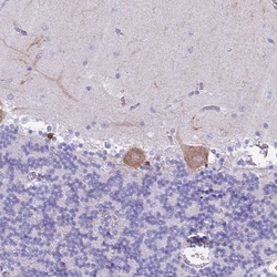 Invitrogen MTSS1L Polyclonal Antibody 100 &mu;L; Unconjugated:Antibodies,