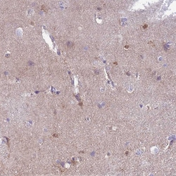 Invitrogen MTSS1L Polyclonal Antibody 100 &mu;L; Unconjugated:Antibodies,