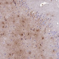 Invitrogen MTSS1L Polyclonal Antibody 100 &mu;L; Unconjugated:Antibodies,