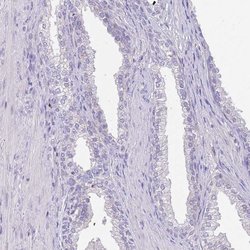 Invitrogen CCDC42B Polyclonal Antibody 100 &mu;L; Unconjugated:Antibodies,