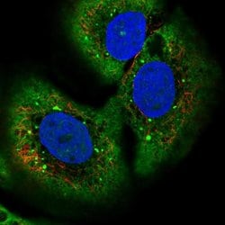 Invitrogen TMEM27 Polyclonal Antibody 100 &mu;L; Unconjugated:Antibodies,
