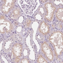 Invitrogen TMEM27 Polyclonal Antibody 100 &mu;L; Unconjugated:Antibodies,