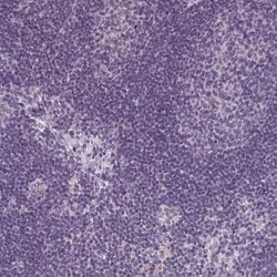Invitrogen TMEM27 Polyclonal Antibody 100 &mu;L; Unconjugated:Antibodies,