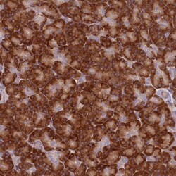 Invitrogen SPATA2 Polyclonal Antibody 100 &mu;L; Unconjugated:Antibodies,
